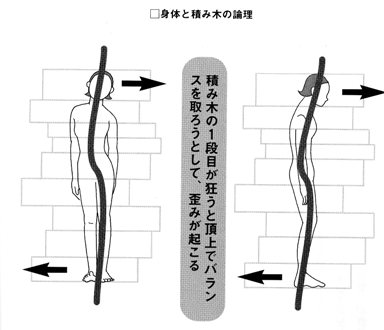 身体の歪みの論理