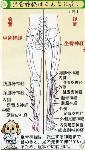 坐骨神経痛の長さ